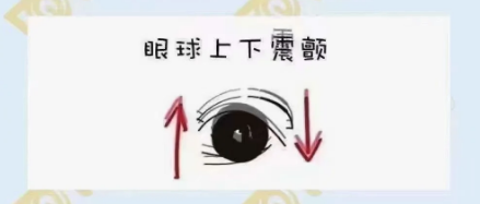 什么是眼球震顫？