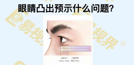 眼睛凸出預(yù)示著什么問(wèn)題