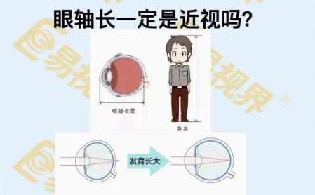 眼軸長一定是近視嗎？