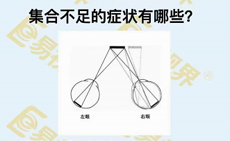 集合不足的癥狀有哪些？